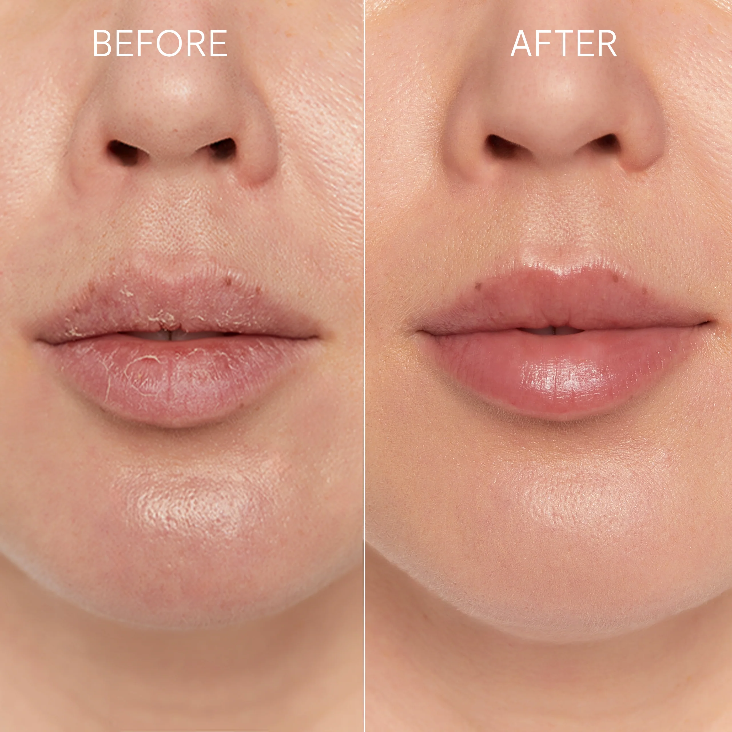 GLOV® Kiss&Kiss Set- Zestaw do peelingu ust - Image 3