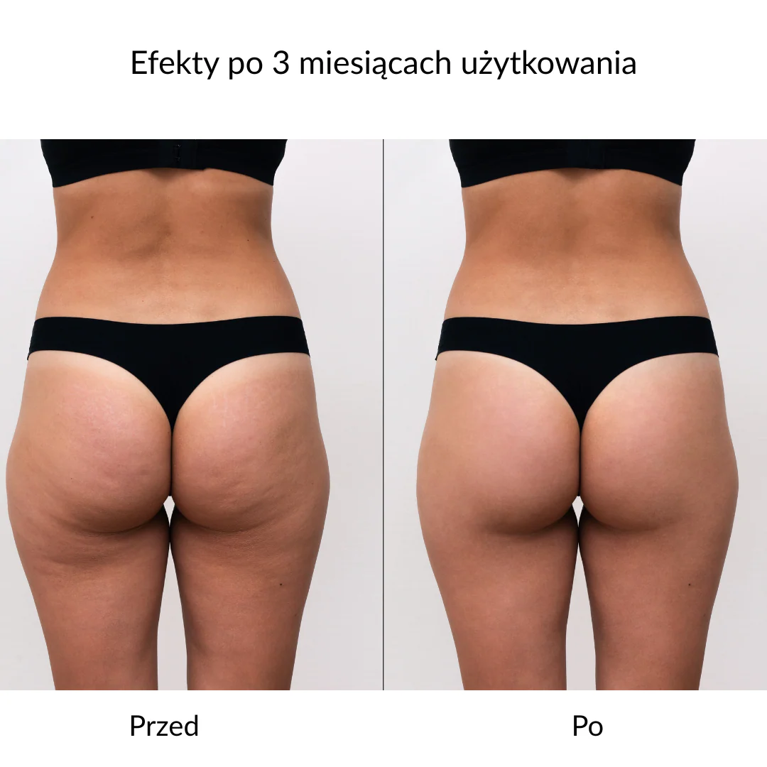 Rękawica do peelingu i mycia ciała GLOV® - Image 10